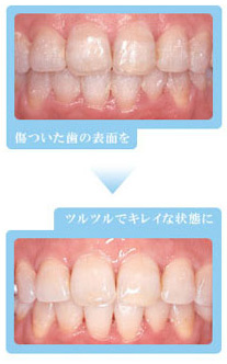 もっと自信が持てる歯を手に入れたい