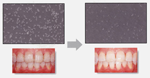 歯のトリートメントサプリ